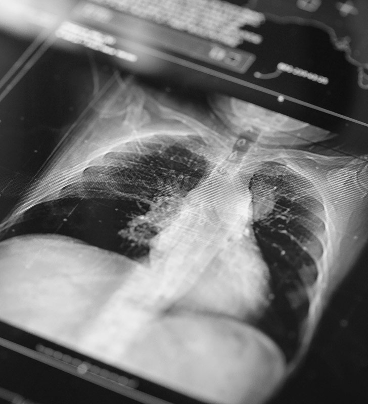 Respiratory – x-ray of lungs